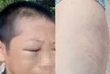 Xôn xao clip bé trai mắt bầm tím, khóc kêu cứu vì nhiều lần bị đánh đập khi ở cùng bố và vợ mới